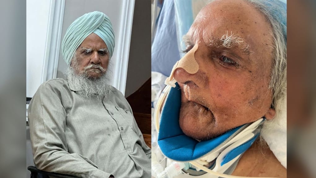 Family of Sikh man speaks out against Toronto-area hospital after beard shaved