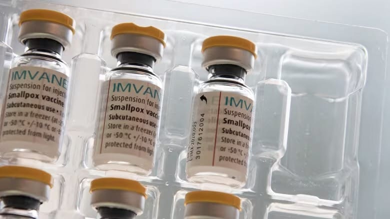 2nd mpox vaccine dose still needed by Canadians at risk: public health post image