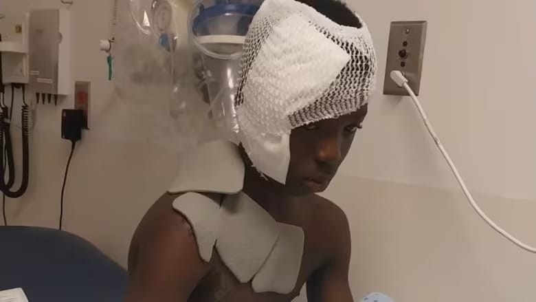 Montreal-area boy severely burned after stranger throws boiling water on him post image